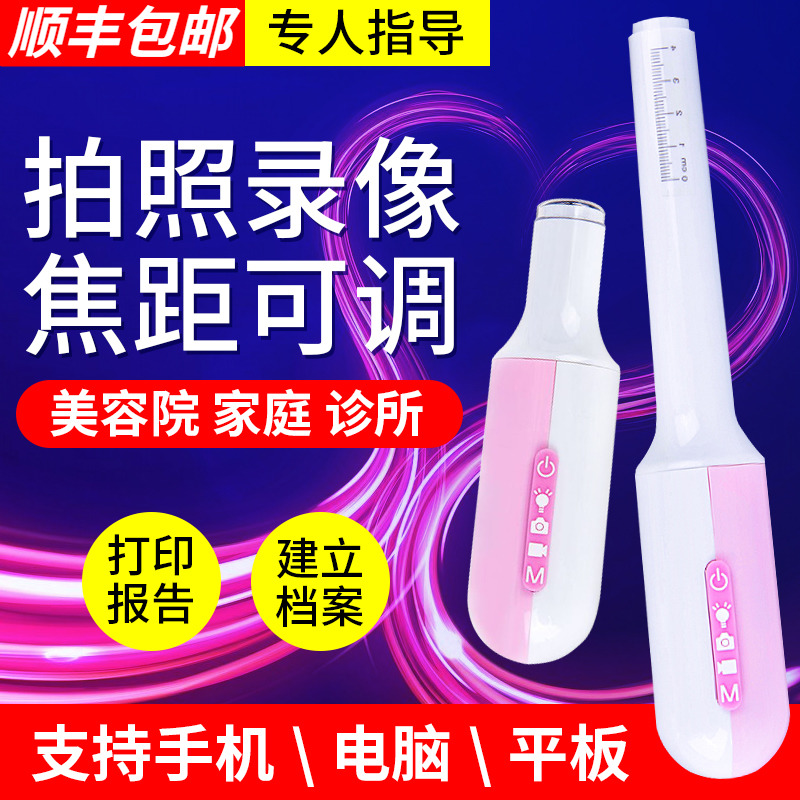 Gynecological endoscopy High-definition visual inspection Female colposcopy intimate examination instrument Cervical detector snooping examination device