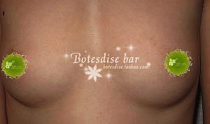 Soutien-gorge invisible jeunes femmes - Ref 784738 Image 16