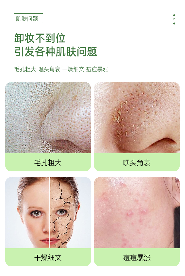 Nước tẩy trang Nho xanh Ruwei RNW được ủy quyền chính thức Làm sạch sâu và nhẹ nhàng lỗ chân lông, mắt, môi và mặt 3 trong 1 tẩy trang garnier vàng