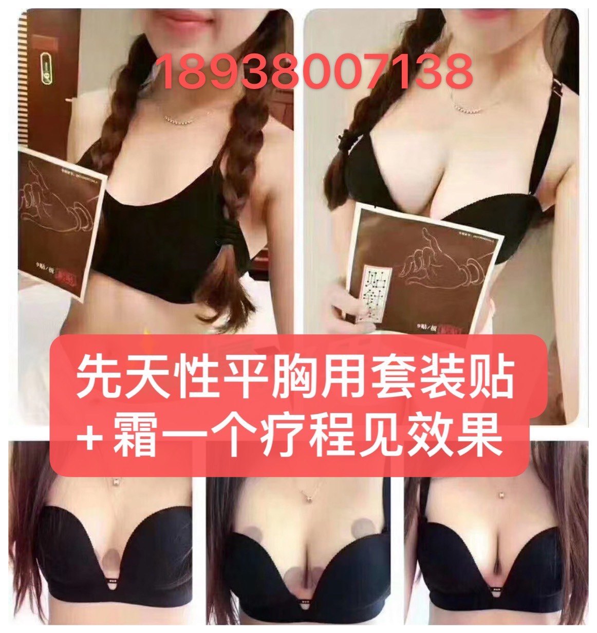 Traditional Chinese Medicine Breast Augmentation and Acupuncture Patch Safety Effective Increase Lifting Cup Dredge Breast Improvement Sagging