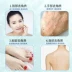 Qiya truy cập năng lượng mới làm đẹp tinh chất kem dưỡng ẩm làm sáng da massage sữa dưỡng da làm sáng da - Kem massage mặt