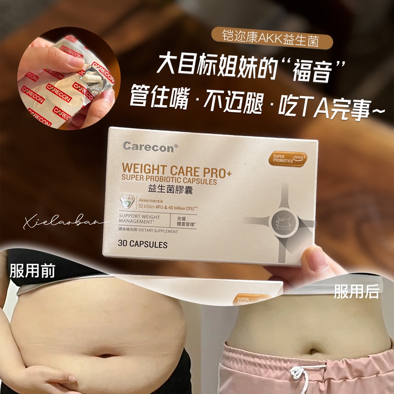 Carecon Akk Slimming Probiotics for Women Comprehensive Nine-Strain Intestinal Probiotic Capsules Hong Kong Direct Mail Authentic Product Carecon Akk Slimming Probiotics for Women Comprehensive Nine-Strain Intestinal Probiotic Capsules Hong Kong Direct Mail Authentic Product