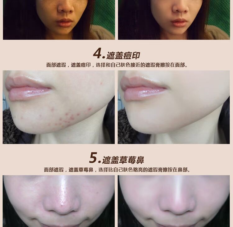 Authentic Sokcho BB Perfect Che khuyết điểm Trang điểm khỏa thân Che vòng tròn tối Mụn In Tàn nhang đốm mụn Trang điểm Trang điểm che khuyết điểm black rouge