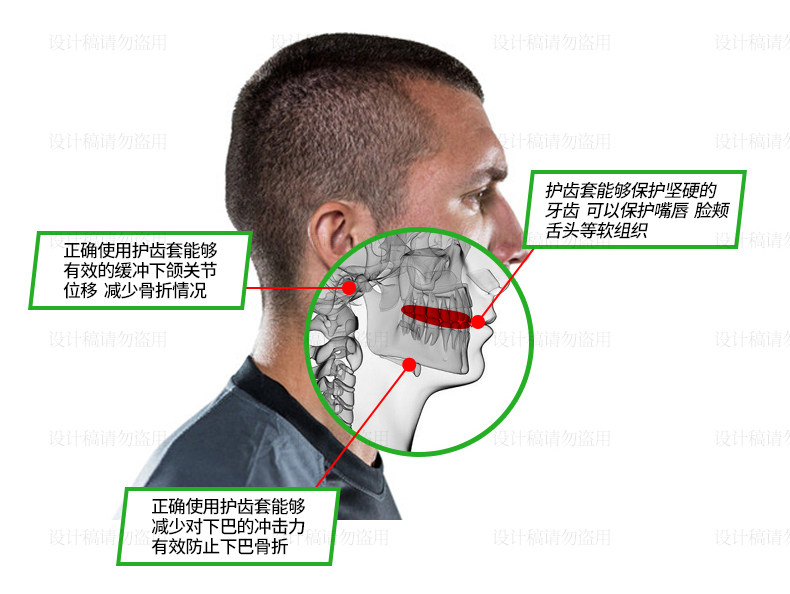 Защитная крышка_05.jpg