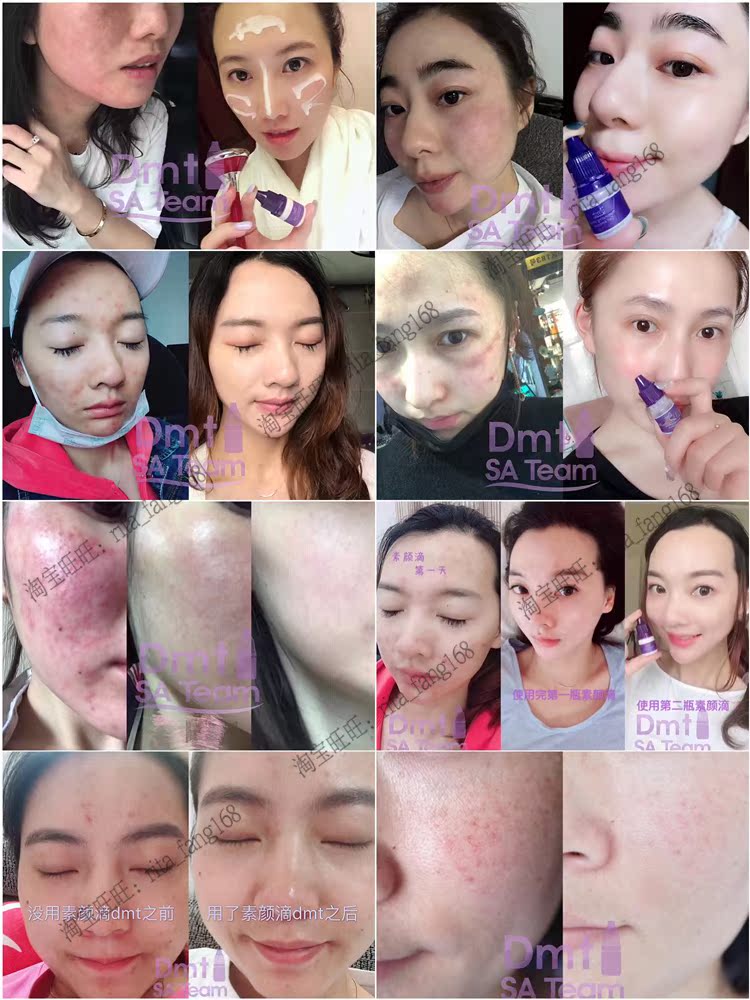 Hàn Quốc DMT Su Yan Drop Essence demedeotem Essence Brightening Moisturising Magiê White 10 Spot serum ciracle b5