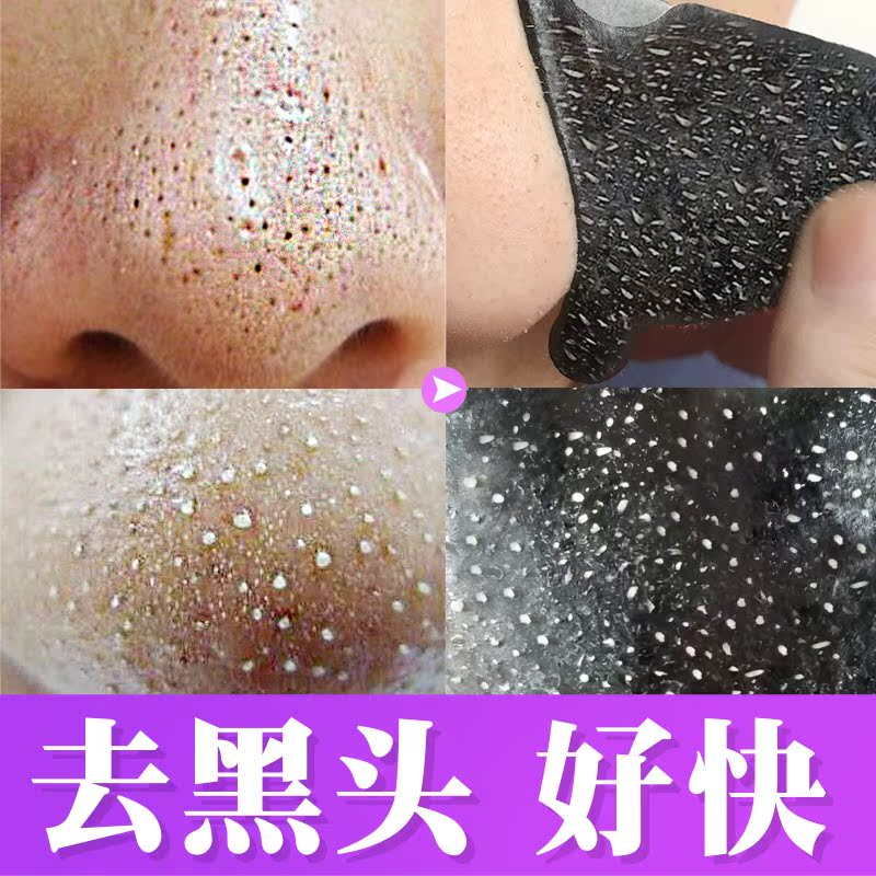 去黑头鼻贴撕拉式男女通用祛粉刺吸黑头鼻膜收缩毛孔套装猪鼻贴