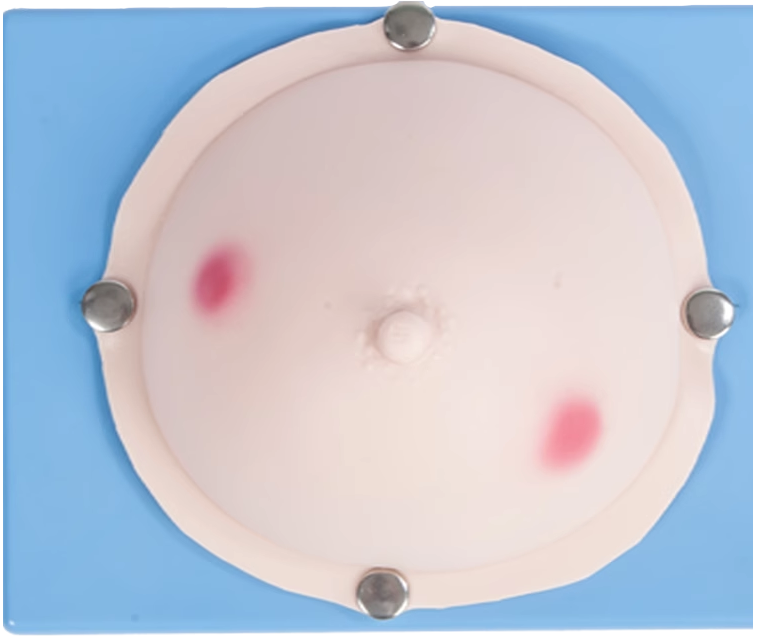 乳腺脓肿切开操作模型 乳腺脓肿检查训练模型
