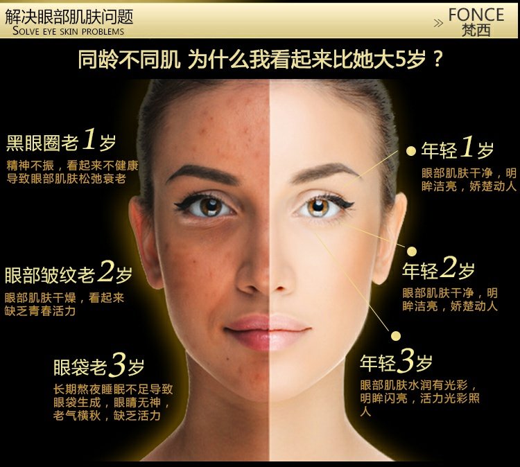 Fanxi để quầng thâm mắt kem mắt túi khô dòng chống nhăn chăm sóc mắt làm mờ nếp nhăn giữ ẩm kem mắt chứa retinol
