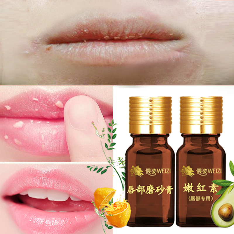 偎姿嫩红素唇部口红去角质磨砂膏护理去死皮淡化唇色唇纹唇膜套装