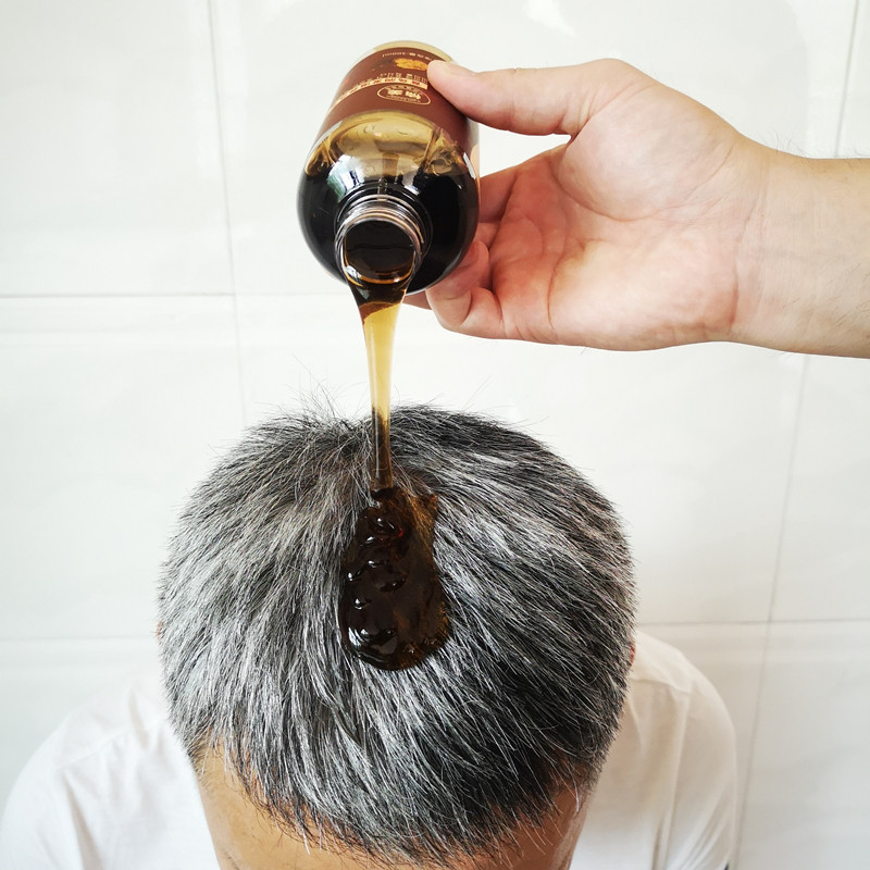 (secret that cannot be said) black and bright hair has a good life ~ 188 yuan 5 bottles ~ 132 yuan 3 bottles