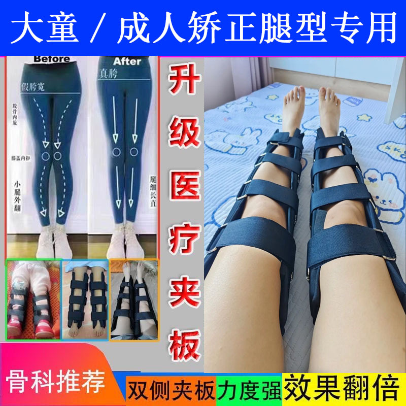 Adult O-Leg/X-Leg/Xo-Leg Correction Belt, Bow-Leg Brace, Calf Valgus Corrector, Straight Leg Device