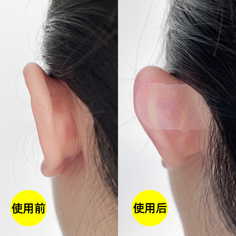 Genie Ear Stickler with Anemone Sticker fixed post Waterproof Cockatoo with small photo correction holder silicone gel-Taobao