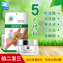 Remove chicken skin pimples hair follicles keratinization keratinization around the hair keratinization snake skin fish scales legs Vitamin a body milk