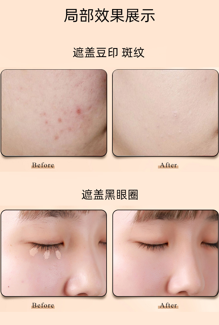 VT Kem che khuyết điểm Tiger Kem che khuyết điểm Paste Gã khổng lồ bị che khuất mụn trứng cá Cove mụn trứng cá lấp lánh mặt tối màu lâu dài che khuyết điểm kryolan