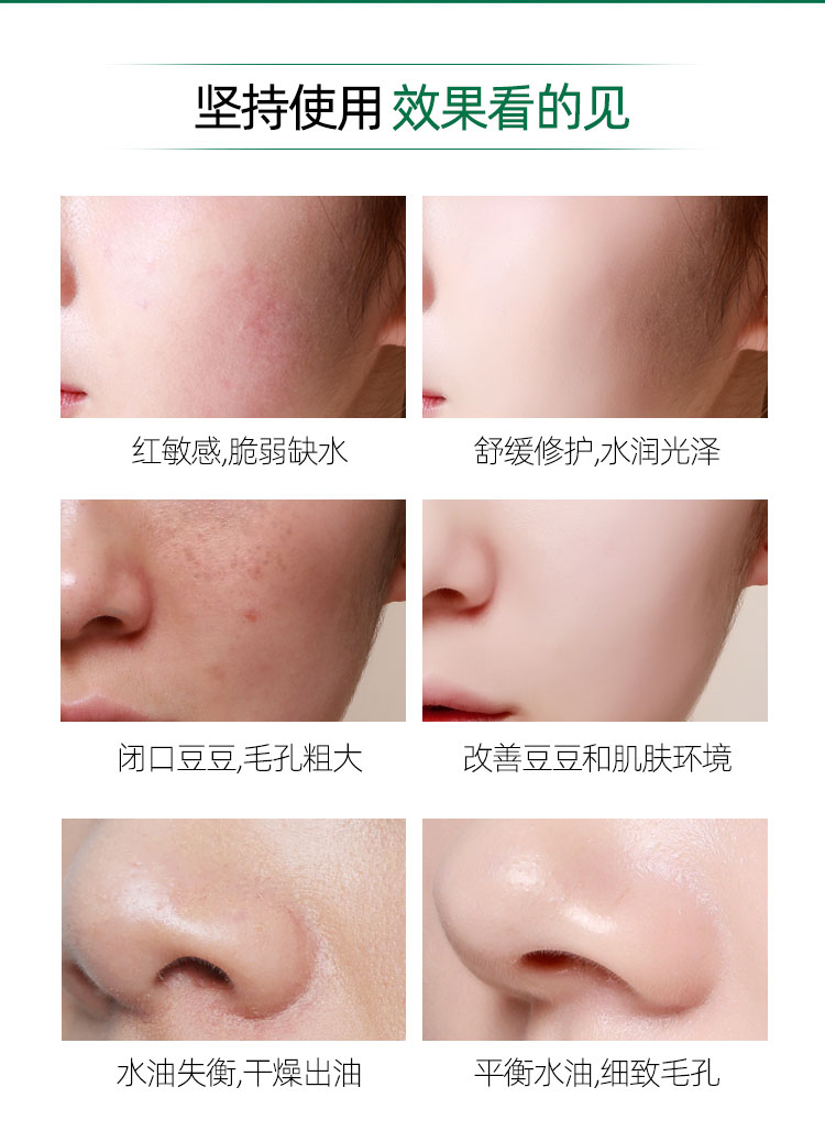 Hàn Quốc Tiji Cơ bắp DRG / Dr.g Cream Cỏ tuyết Hydrat hóa dưỡng ẩm cao Sửa chữa nhũ tương Làm mới và nhờn