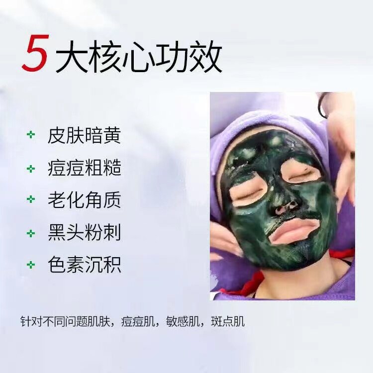 The concentration of sponge microneedle of 40 - 50 % improves the black head of the rough dark acne pit