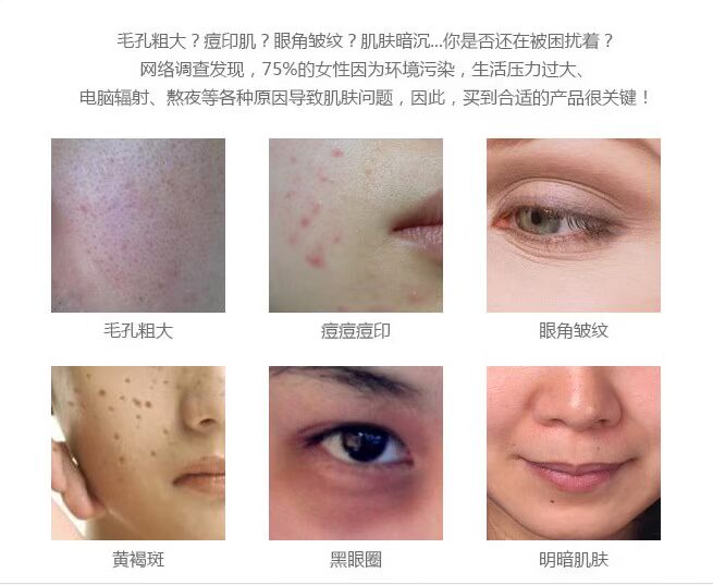 Kem lót PASHA của Pháp, kem che khuyết điểm, bút che khuyết điểm, mụn trứng cá, mắt đen, phụ nữ, khuyến nghị lớn nhất của tôi kem che khuyết điểm loreal