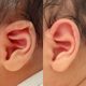 Baby auricle correction artifact baby ear lop ear flapping ear ear clip shaping newborn silicone ear deformity