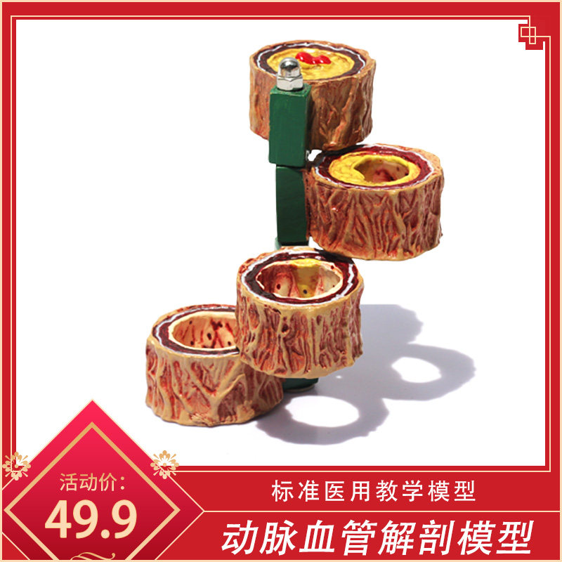 血管/堵塞 血液浓度脂肪 病理血液 血管粥样/血管病理解剖 模型