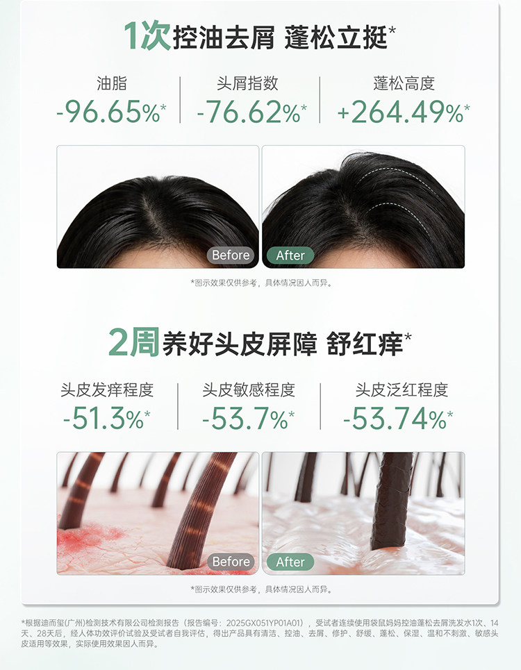 袋鼠妈妈洗发水蓬松控油洗发露备孕洗护套装妇女专用护肤清洁保湿 — 10