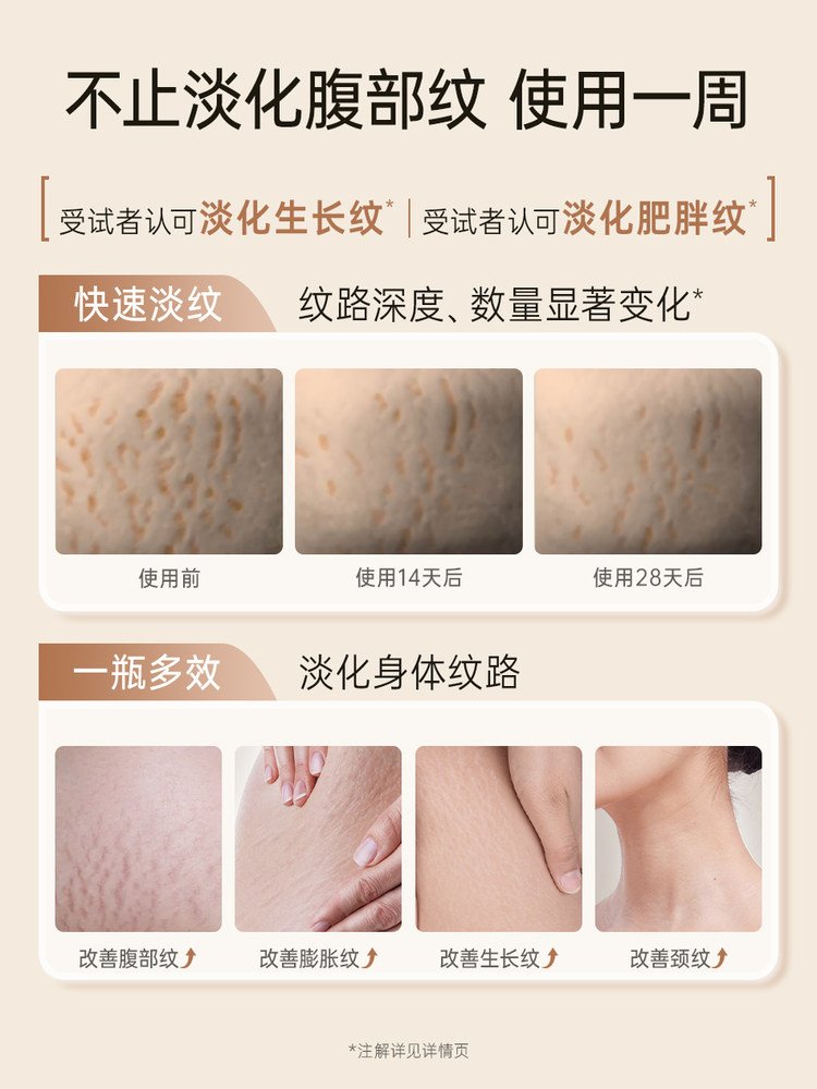 Kangaroo Mom Pregnancy Oil for Pregnant Women to Prevent and Reduce Stretch Marks, Special Double Extract Small Gold Bottle Essence Oil Body Lotion