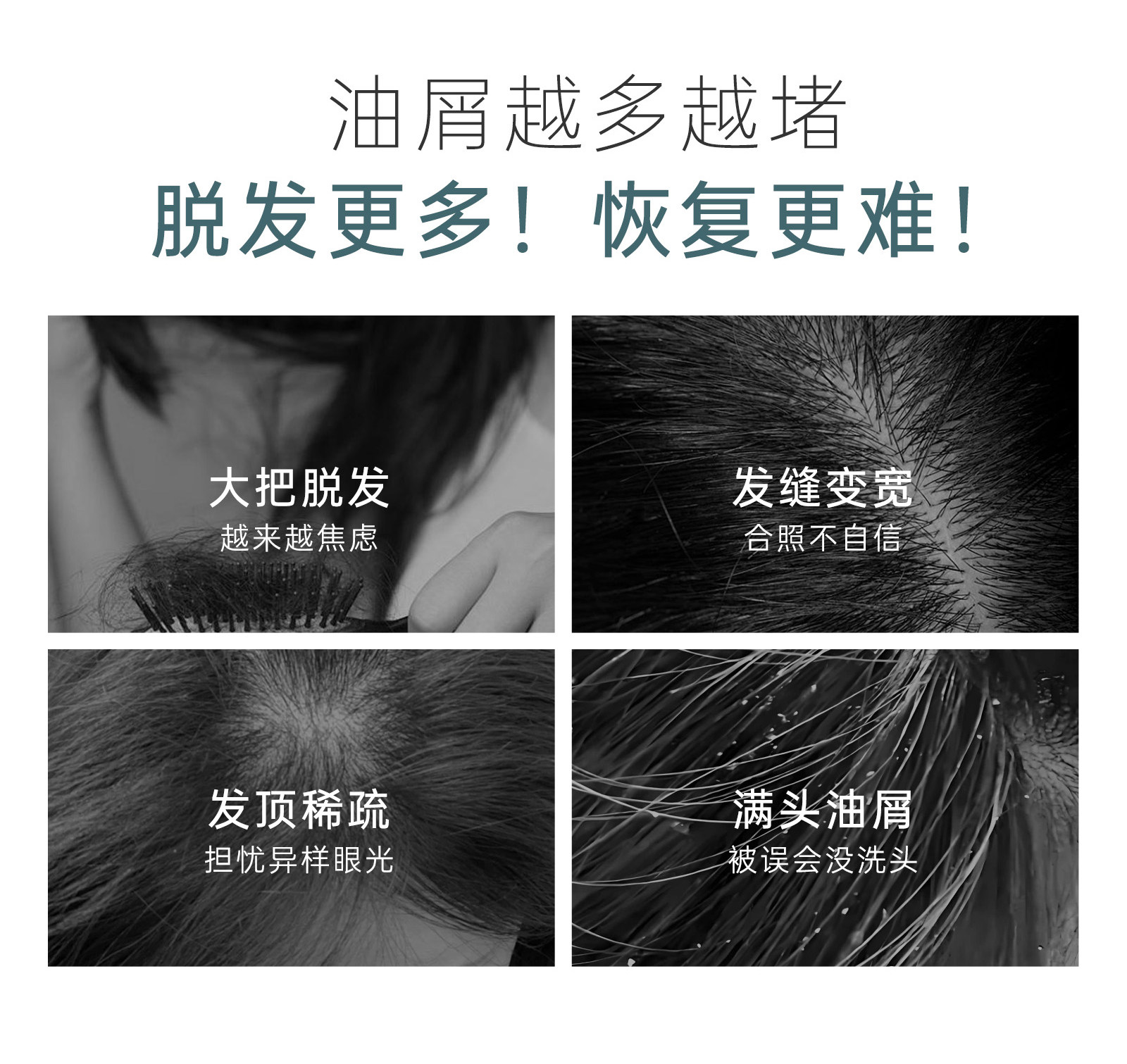 袋鼠妈妈防脱洗发水控油去屑专用生姜养发固发洗发露正品旗舰店 — 5