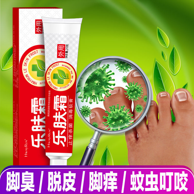 Huiyuanle skin cream 20g anti-itch cream peeling feet and feet itchy itchy feet dry and refreshing