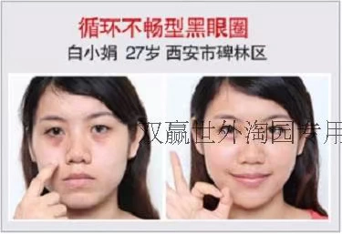 Zhuangdi Serum Mắt để Khử Mùi Tối Vòng Tròn Túi Mắt Dòng Fine Làm Săn Chắc Nhẹ Nhàng Thảo Dược Giải Pháp Chăm Sóc Mắt