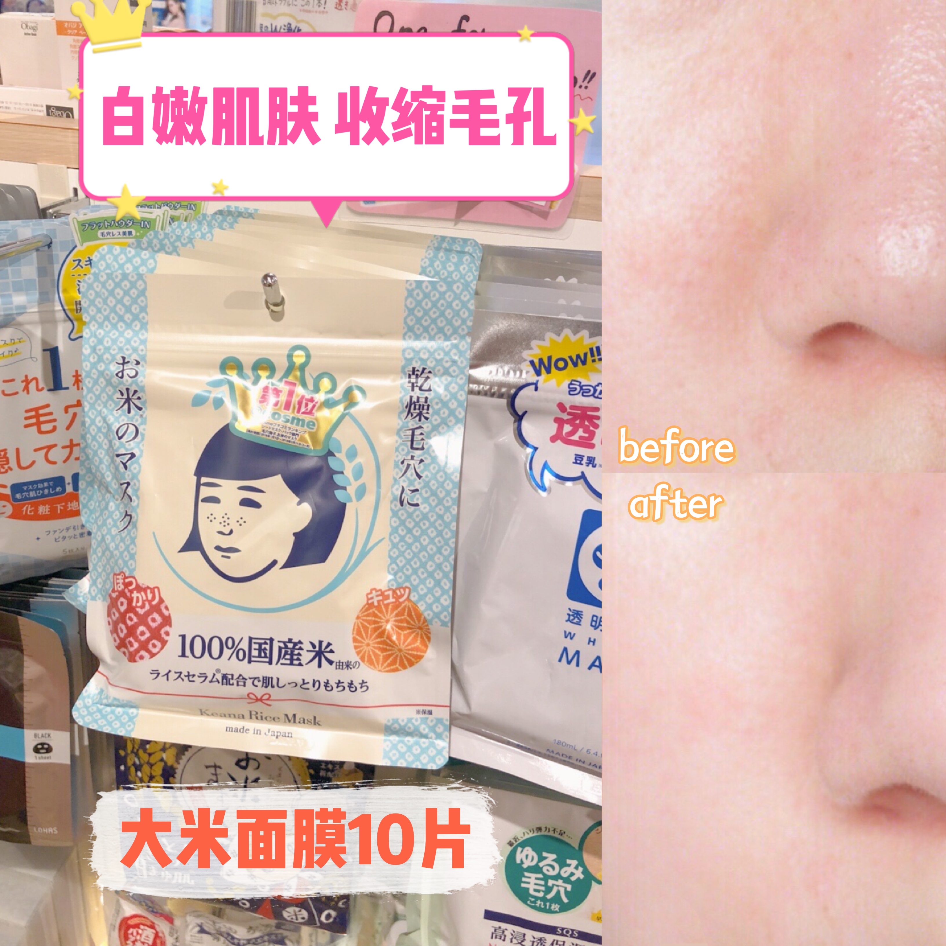 Japanese Shize Institute Fur Caressing Rice Mask Moisturizing Moisturizing Control Oil Shrink Pores Patch 10 Pieces