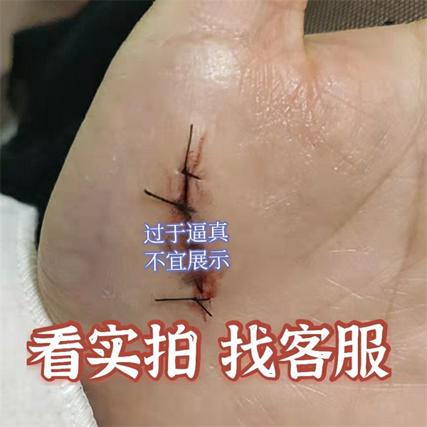 Scar Simulation Patch, Suture Wound Patch, Scar Tattoo Patch, Surgical Scar Tattoo Patch, Scar Sticker, Suture Sticker Scar Simulation Patch, Suture Wound Patch, Scar Tattoo Patch, Surgical Scar Tattoo Patch, Scar Sticker, Suture Sticker
