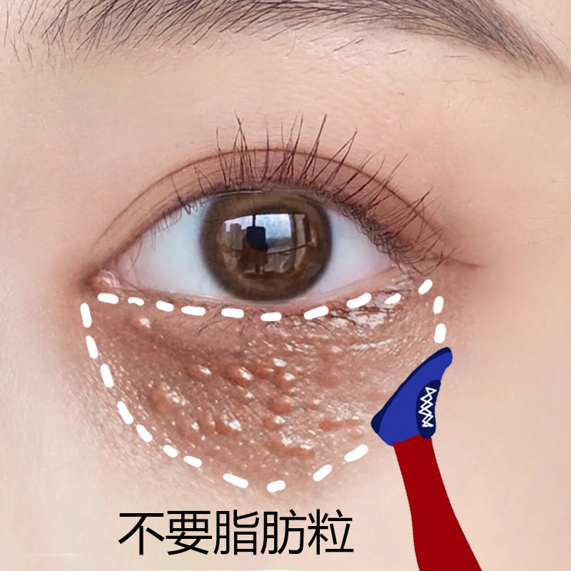 (Recommended by Li Jiaqi) Retinol Essence Says Goodbye to Fat Granules and Sweat Tube Granules Artifact Available for Men and Women~