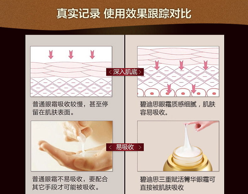 Kem dưỡng mắt Snail Các nếp nhăn, làm săn chắc, nâng, chống nhăn, giữ ẩm, quầng thâm, túi mắt, chăm sóc mắt, nam và nữ kem trị thâm quầng mắt
