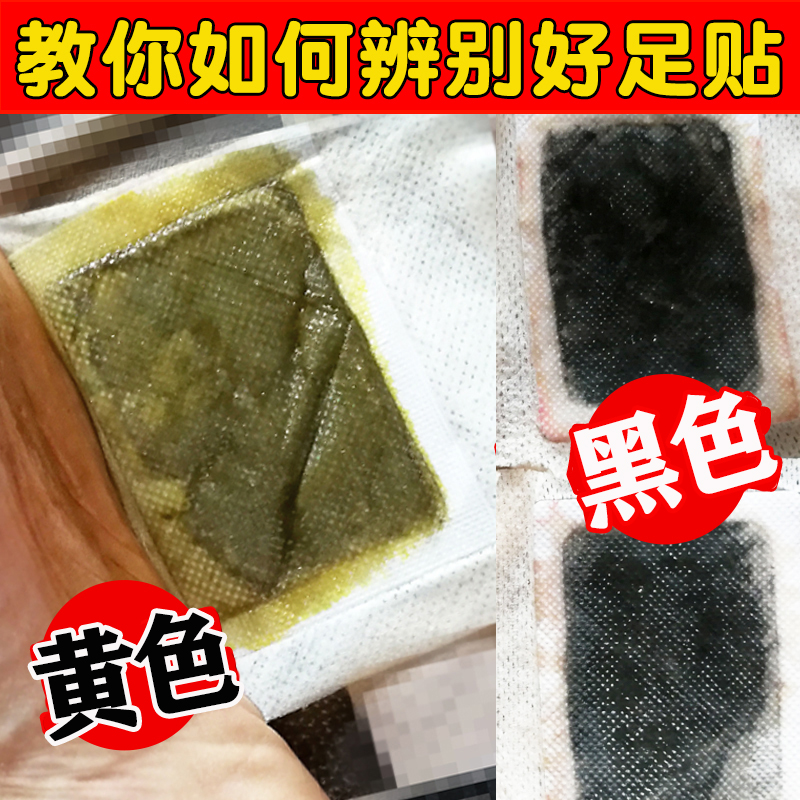 Old Beijing Ginger Foot Patch Wormwood Wormwood Leaf Wormwood Sleep Exclusion Moisture Foot Patch Sleep Poison Dispel Cold