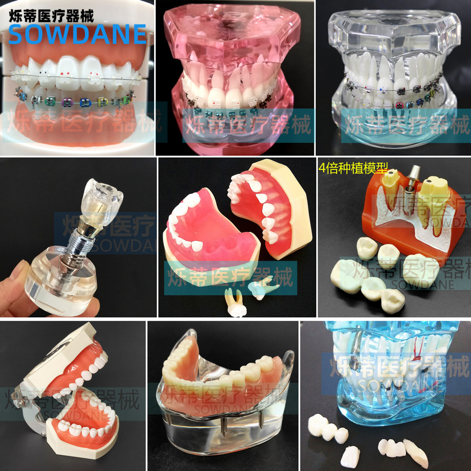 Dental Oral Pathology Prosthetic Model Implant Model Orthodontic Explanation Model Doctor-Patient Communication Teaching Dental Model