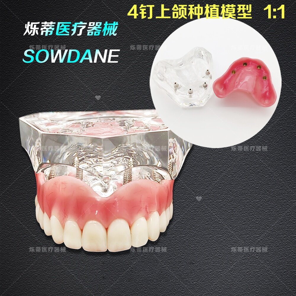 牙科 教学模型 种植模型 4钉上颌医患沟通 透明 分解模型齿科牙模