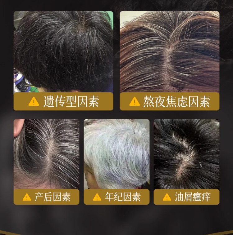 【中國直郵】 宏綠 何首烏洗髮皂 側柏葉黑靈芝洗頭餅中藥烏斯曼草五黑烏發手工皂 120g/盒