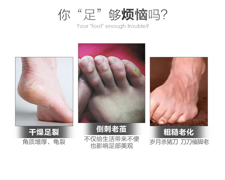 Bắn 3 nhận được 22 chân phim làm trắng giữ ẩm bộ phim chân để loại bỏ da chết cũ đấu thầu dịu dàng gót khô nứt tẩy tế bào chết chăm sóc bàn chân kem bôi nứt gót chân