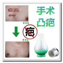 Removes facial melanin deposits burns and fades raised pimples. This ointment is specially designed for postpartum repair of caesarean section scars.