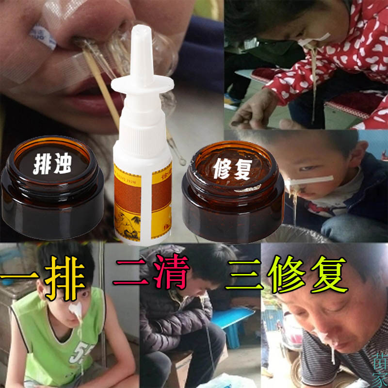 Miaojia Ebucaicao Rhinitis Ointment for Children with Allergic Nasal Septum Hypertrophy, Nasal Clearing Magic for Adults, Authentic Chinese Medicine