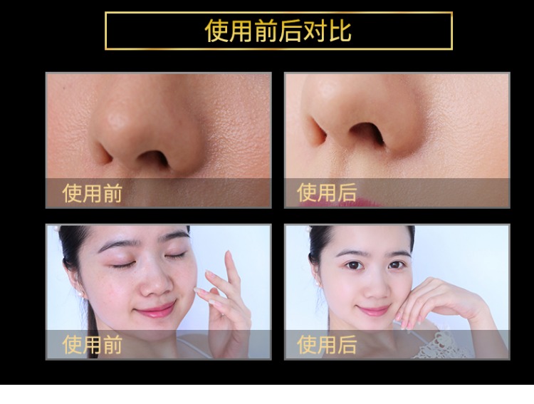 Yan Suzhen Liusheng Peptide Solution Anti-Wrinkle Firming Hyaluronic Acid Facial Facial to Desalination Wrinkles serum fracora
