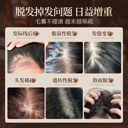 Шампунь с имбирем, контроль жирного блеска, придает объем, удаление перхоти, против зуда