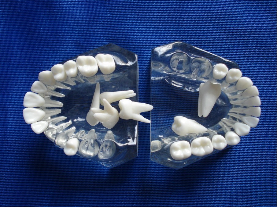 Crystal Clear Tooth Model Removable Plucking Teeth Practice Tooth Anatomical Construction Model