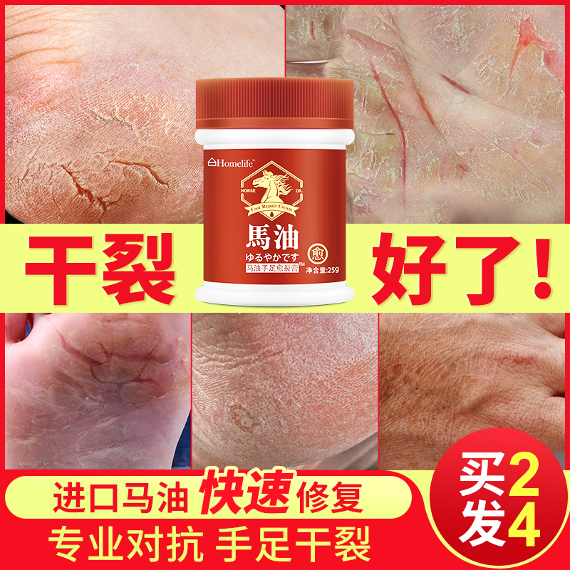 Horse oil heel dry crack crack crack frostbite cream anti-crack hand and foot crack repair cream healing crack hand cream men and women