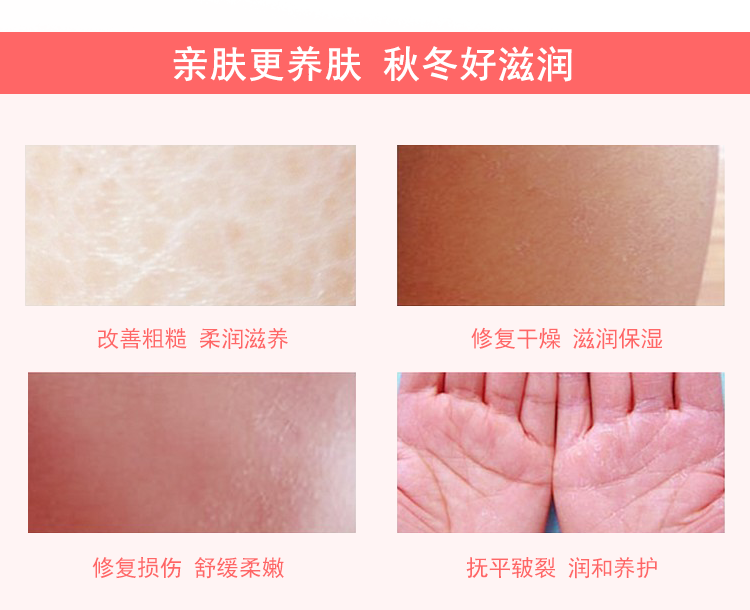 Longliqi Cừu Placenta SOD Mật Ong 90 + 15 ml Dưỡng Ẩm Kem Dưỡng Da Cơ Thể dưỡng ẩm