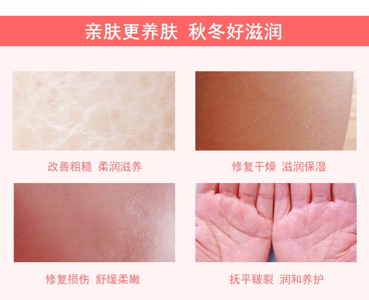 Longliqi Cừu Placenta SOD Mật Ong 90 + 15 ml Dưỡng Ẩm Kem Dưỡng Da Cơ Thể kem dưỡng ẩm dành cho da dầu mụn