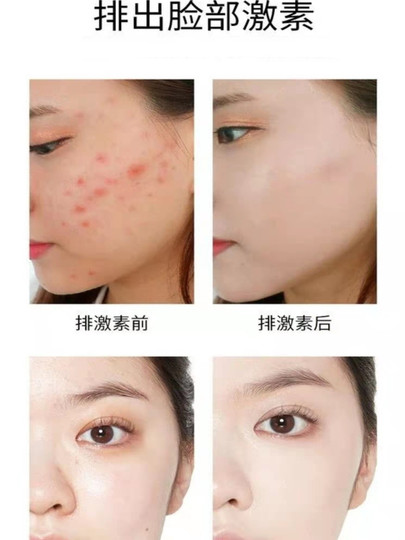 Deep Cleansing Facial Pore Dirt Blockage Deep Cleansing Skin Clearing Cream Massage Cream Detoxifying Facial Authentic Product