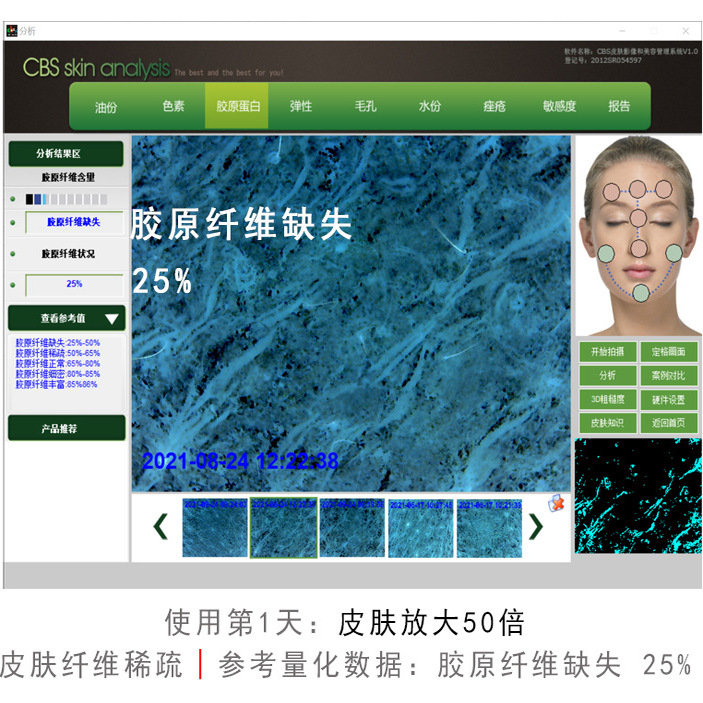 重组三型胶原蛋白冻干粉:焕肤的秘密武器