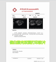 Color porcelain white laser film B ultrasound color ultrasound gastroscope duplex printing Medical printing film paper A4 16K B5