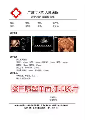 Glossy porcelain white 180 thick color inkjet waterproof film Gastroscope TCT color ultrasound B ultrasound PET printing negatives paper