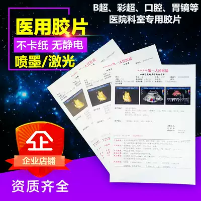 Hospital negatives inkjet laser porcelain white translucent color gastroscope B Super Four-dimensional color Doppler ultrasound printing negative paper